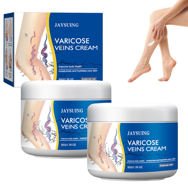 2 Pcs Varicose Veins Cream for Legs, Spider Varicose Veins ReliefCream, SkinCream for Legs, Cream for VaricoseVeins 2 Pcs Varicose Veins Cream for Legs, Spider Varicose Veins ReliefCream, SkinCream for Legs, Cream for VaricoseVeins