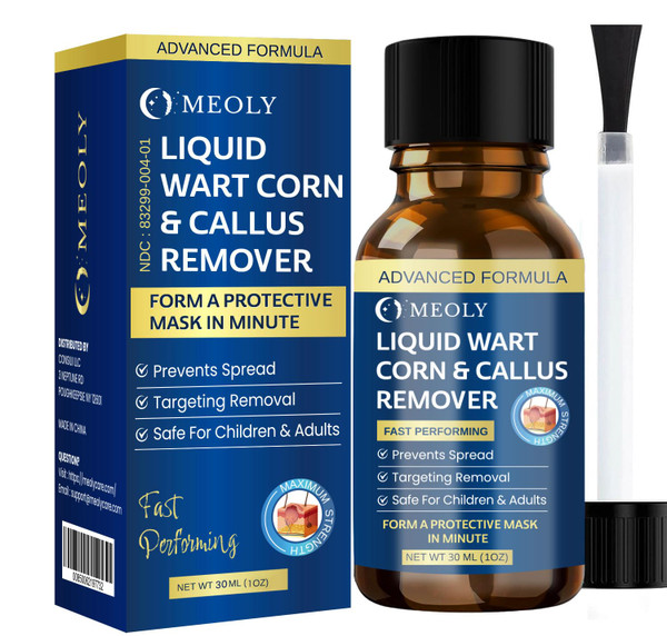 MEOLY Genital Wart Remover Cream: Genital Wart Removal Ointment 15 ML