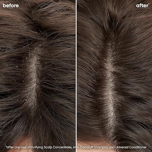 BIOLAGE SCALP SYNC ANTI-DANDRUFF SHAMPOO LITER