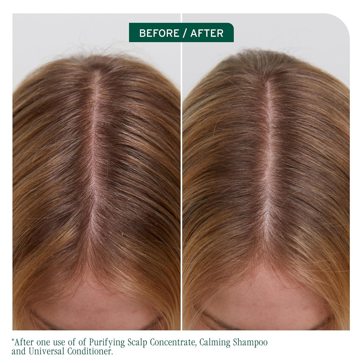 BIOLAGE SCALP SYNC CONDITIONER LITRO