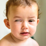 Children's Eye Infections