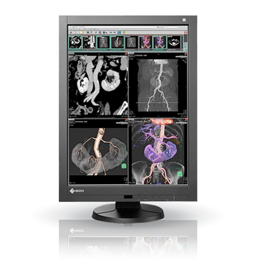 LAC RadiForce RX340 Medical Viewer, RadiForce RX340 Medical Viewer, RX340 Medical Viewer, Medical Viewer, LAC RadiForce RX340, LACRFRX340, RadiForce RX340