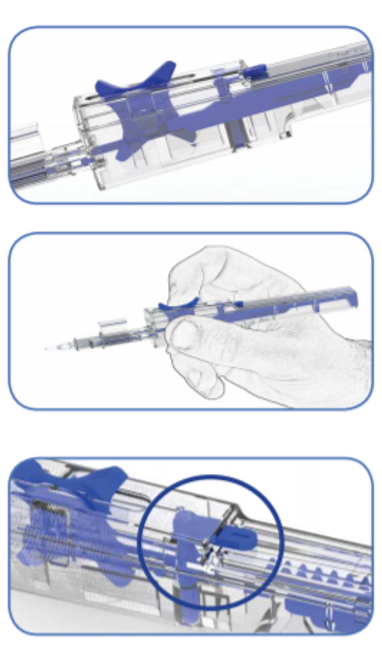 Medicel Ergoject One-Handed Screw Injection System, medicel ergoject, medicel one-handed screw injector, one-handed screw injector, one-handed screw injection system, lens injection system, top-loaded ergoject, back-loaded ergoject, medicel ergoject one-handed, Ergoject One-Handed Screw Injection System