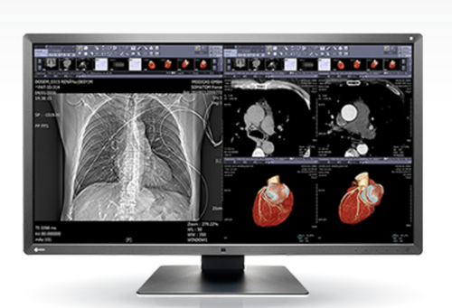 Eizo RadiForce MX315W, Eizo RadiForce, Eizo MX315W, RadiForce MX315W, Eizo Medical Monitor, Medical Monitor