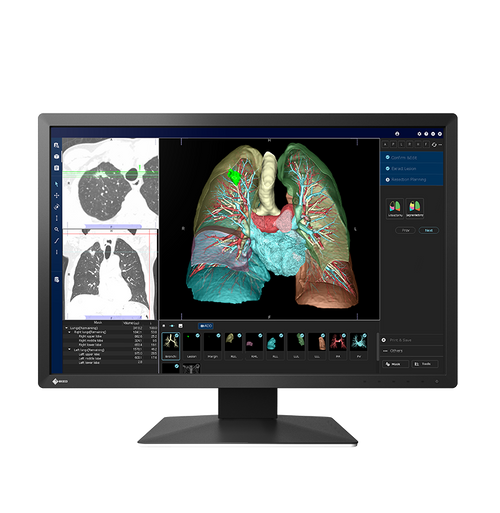 Eizo RadiForce MX243W, Eizo RadiForce, Eizo MX243W, RadiForce MX243W, Eizo Medical Color Monitor, Medical Monitor