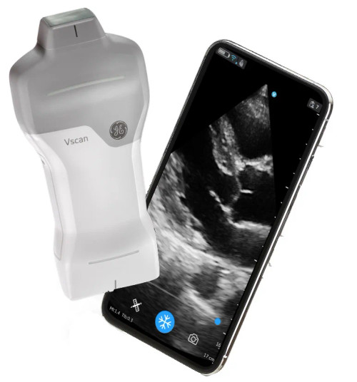 GE Vscan Air portable ultrasound, handheld wireless ultrasound device, best point-of-care ultrasound scanner, pocket-sized ultrasound for clinicians, dual-probe portable ultrasound system, mobile ultrasound for telemedicine and remote care
