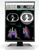 Eizo RadiForce RX360, Eizo RadiForce, Eizo RX360, Eizo Medical Monitor, Medical Monitor