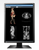 Eizo RadiForce MX216, Eizo RadiForce, Eizo MX216, RadiForce MX216, Eizo Medical Monitor, Medical Monitor