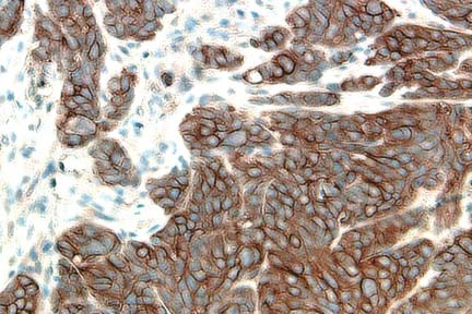 IHC-Tek HRP Anti-Goat Polymer Detection Kit - 10 ml Ready to Use