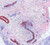 SMA staining without using antibody diluent