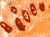 NovaUltra Alizarin Red Stain Kit