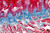 NovaUltra Masson Trichrome Stain Kit
