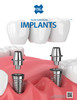 OSG_-_Product_Flyer_-_Industry_-_Dental_Implants_-_Vol_1-2_-_IA
