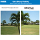UltraVue screen visibility, UltraVue screen before and after, what does UltraVue screen look like