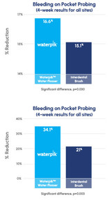 The Waterpik Water Flosser: Significantly More Effective than Interdental Brush for Improving Gingival Health
