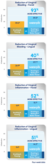 Waterpik Water Flosser: Over 50% More Effective than String Floss for Reducing Gingivitis