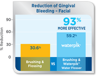 Waterpik Water Flosser: Over 50% More Effective than String Floss for Reducing Gingivitis