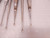 LOT OF 7 CURETTES T78625