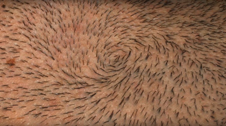 Even on the smoothest face, skin is loose and gel-like; beard hairs are hard, wiry and grow in several random directions.
