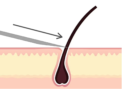 Razors