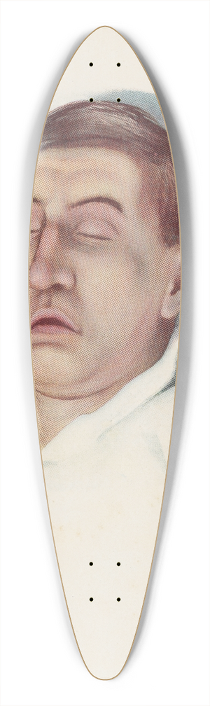 A. Kirkpatrick Maxwell - Plate III. Pallid type of asphyxia from phosgene poisoning, with circulatory failure 39.3 inch art pintail longboard deck