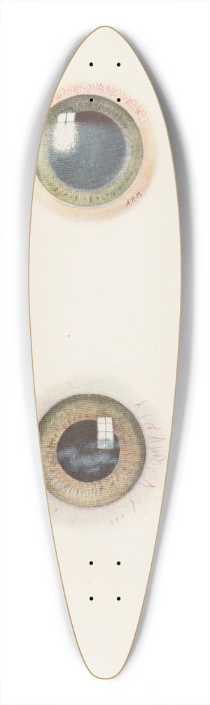 A. Kirkpatrick Maxwell - Plate XIII. A. Drawing of the cornea in the acute stage of severe burning. B. Drawing of cornea in the stage of resolution after severe burning 39.3 inch art pintail longboard deck