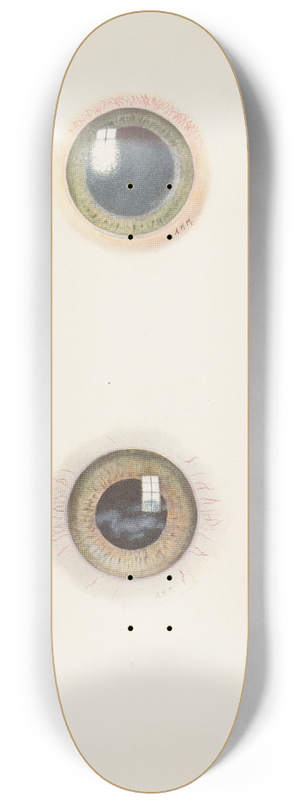 A. Kirkpatrick Maxwell - Plate XIII. A. Drawing of the cornea in the acute stage of severe burning. B. Drawing of cornea in the stage of resolution after severe burning 8.25 inch art skate deck