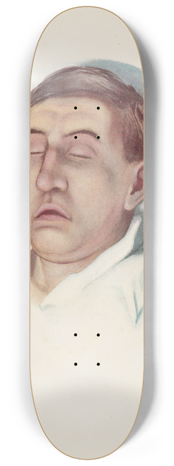 A. Kirkpatrick Maxwell - Plate III. Pallid type of asphyxia from phosgene poisoning, with circulatory failure 8.25 inch art skate deck