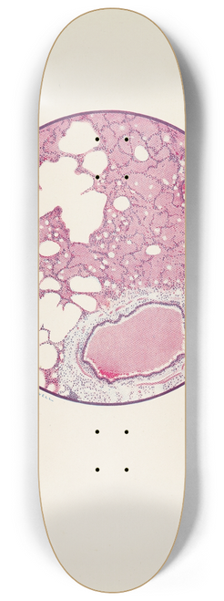 A. Kirkpatrick Maxwell - Plate I. Microscopic section of human lung from phosgene shell poisoning. Death at the nineteenth hour after gassing 8.25 inch art skate deck