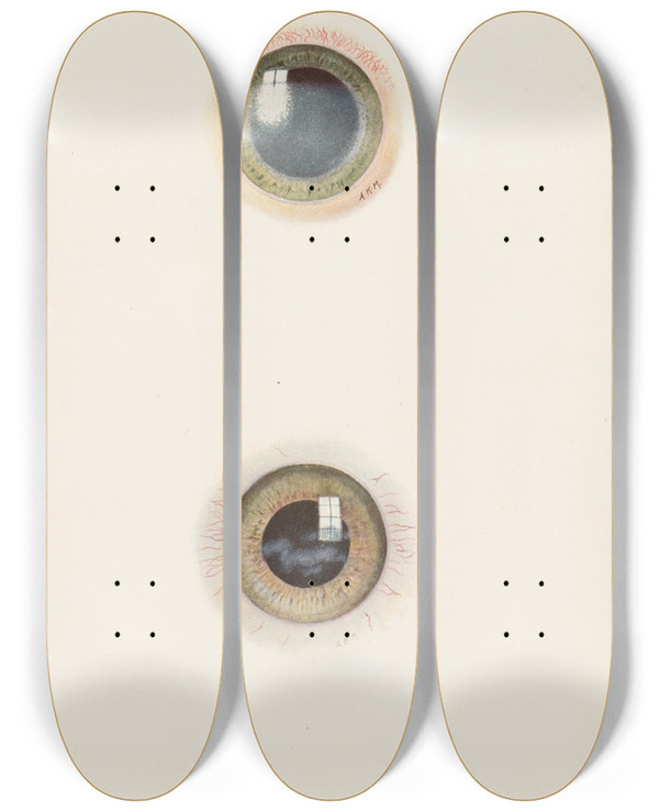 Triptych art skateboard deck of A Kirkpatrick Maxwell Plate Xiii A Drawing Of The Cornea In The Acute Stage Of Severe Burning B Drawing Of Cornea In The Stage Of Resolution After Severe Burning by A Kirkpatrick Maxwell (1884-1975)