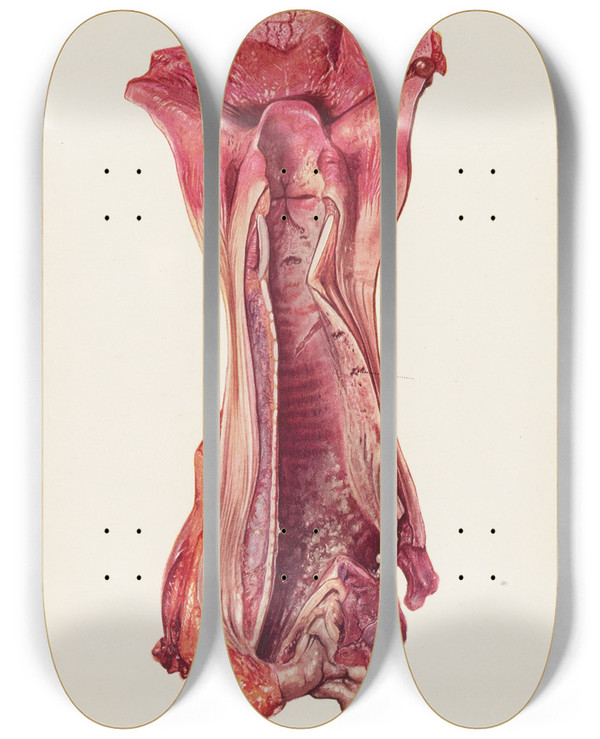 Triptych art skateboard deck of A Kirkpatrick Maxwell Plate Ix Ulceration Of Trachea By Mustard Gas by A Kirkpatrick Maxwell (1884-1975)
