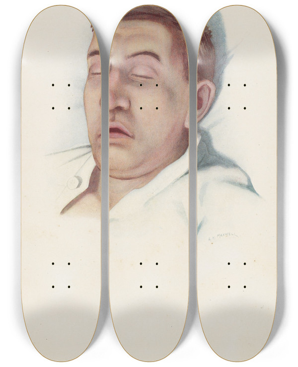 Triptych art skateboard deck of A Kirkpatrick Maxwell Plate Iii Pallid Type Of Asphyxia From Phosgene Poisoning With Circulatory Failure by A Kirkpatrick Maxwell (1884-1975)