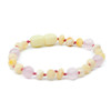 Amber Milky Maximum effect Ankle Bracelet Mixed With Rose Quartz