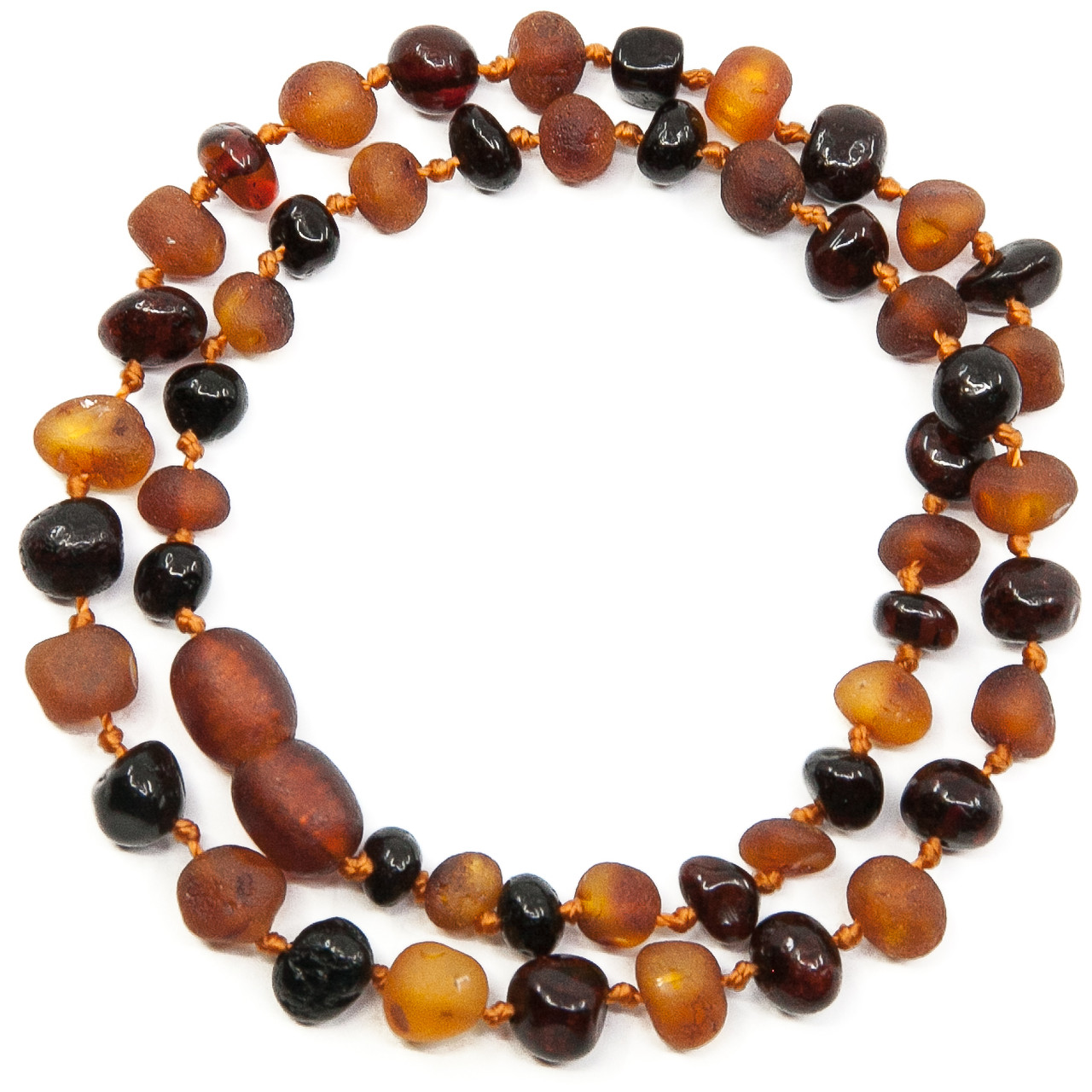 what is a baltic amber necklace