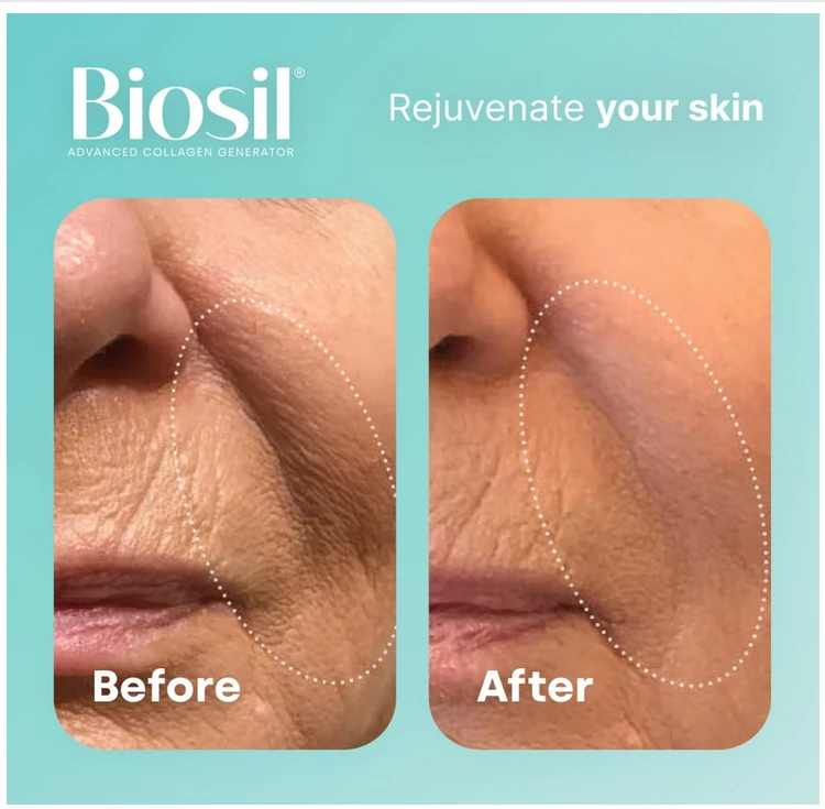 BiosilAdvanced Collagen Generator - 1 fl oz Drops/30ml - with Patented ch-OSA Complex - Generates & Protects Your Own Collagen - GMO Free - 60-Day Supply