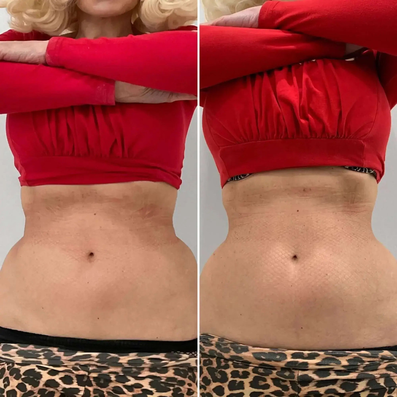 AbFix: Venus - BeautyFixMedSpa
