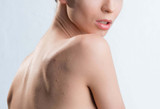 Battling Breakouts: How To Treat Bacne