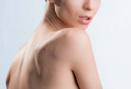 Battling Breakouts: How To Treat Bacne
