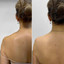 BodyFix: TrapTox