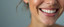 CheekFix: Buccal Fat Reduction