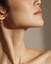 ChinFix: CoolSculpting