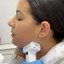 ChinFix: truSculpt iD