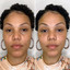 EyeFix: Filler