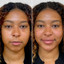 FaceFix: Liquid Face Lift