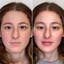 FaceFix: Liquid Face Lift