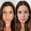 FaceFix: Liquid Face Lift