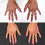 HandFix: Filler