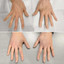 HandFix: Filler