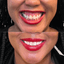 LipFix: Gummy Smile