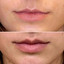 LipFix: LipFlip